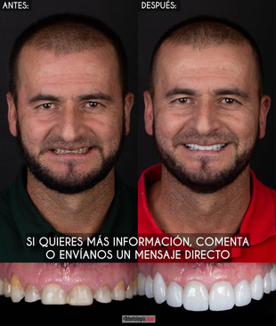 Slider image (2) Odontologia Laser